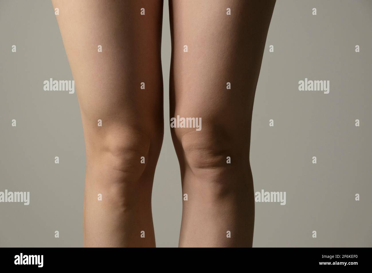 Overweight knees, contrast lightning. Woman`s hips closeup raw studio shot in grey background. Dieting and fat loss concept. Stock Photo